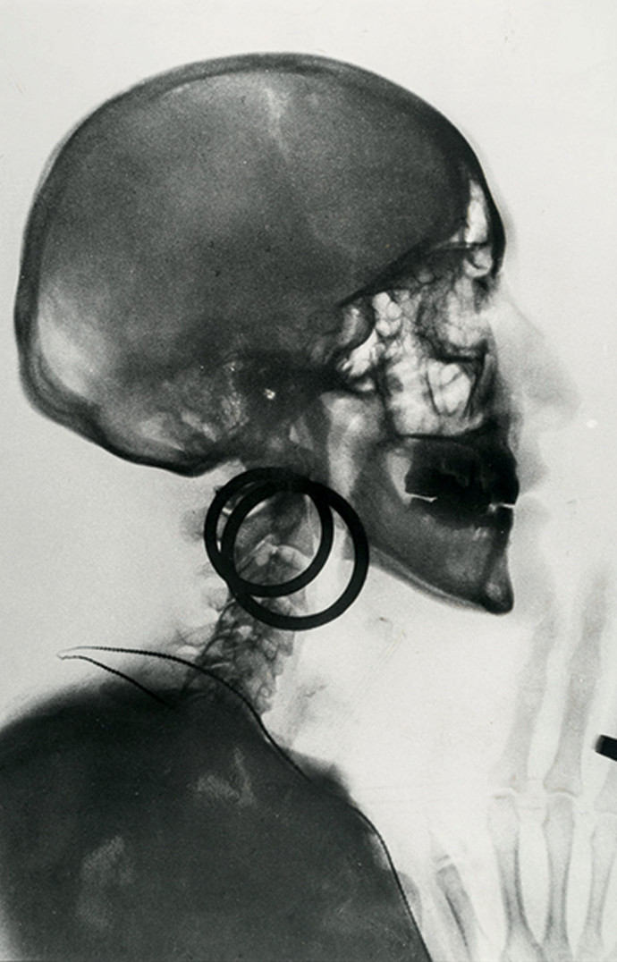 Radiographie du crâne de M. O., Meret Oppenheim, 1964.